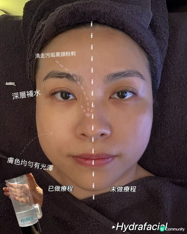 我最喜愛facial 療程No 1 🥇🥰
