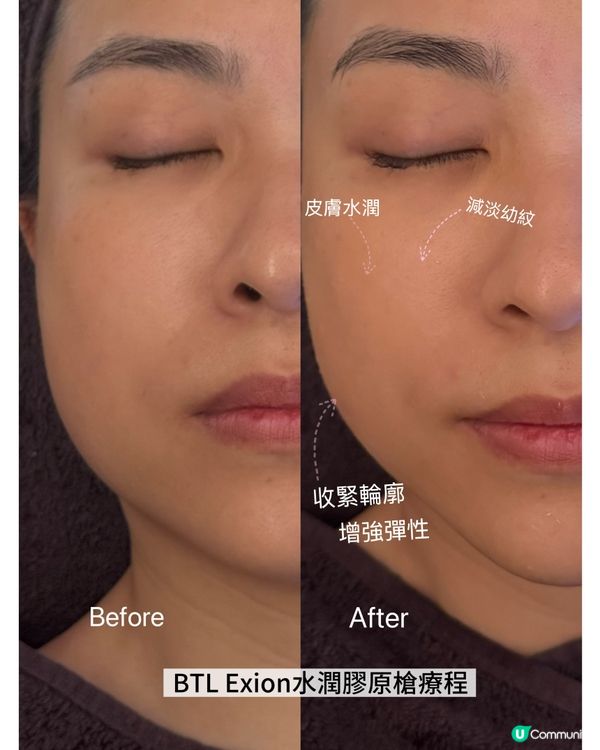 我最喜愛facial 療程No 1 🥇🥰