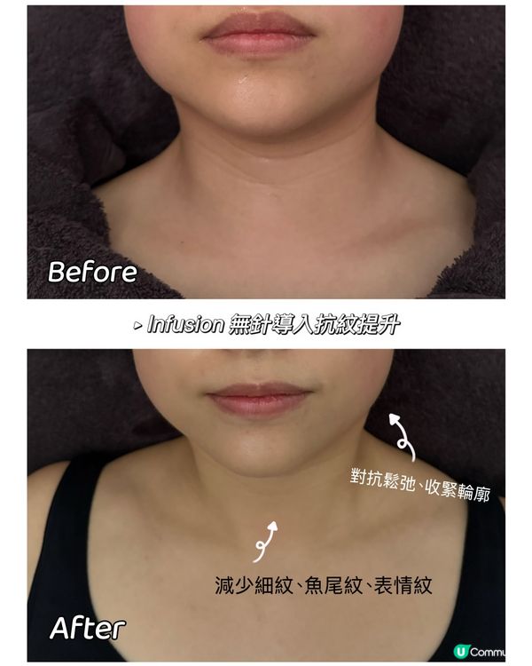 我最喜愛facial 療程No 1 🥇🥰