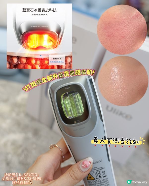 淡斑去紅神器！超光炮實測🤩！一機搞掂？