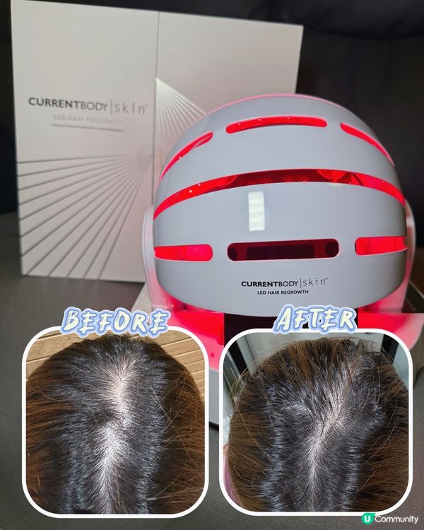 光療生髮帽 生髮救星🤩 10分鐘搞掂！