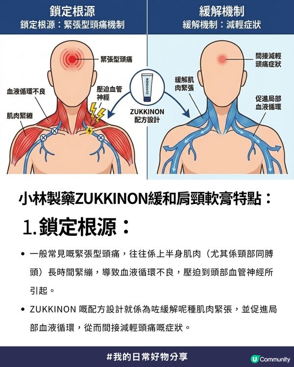 【Threads爆紅🔥】專治肩頸痠痛連帶「緊張型頭痛」😲 - 日本討論度極高「神級頭痛軟膏」✨
