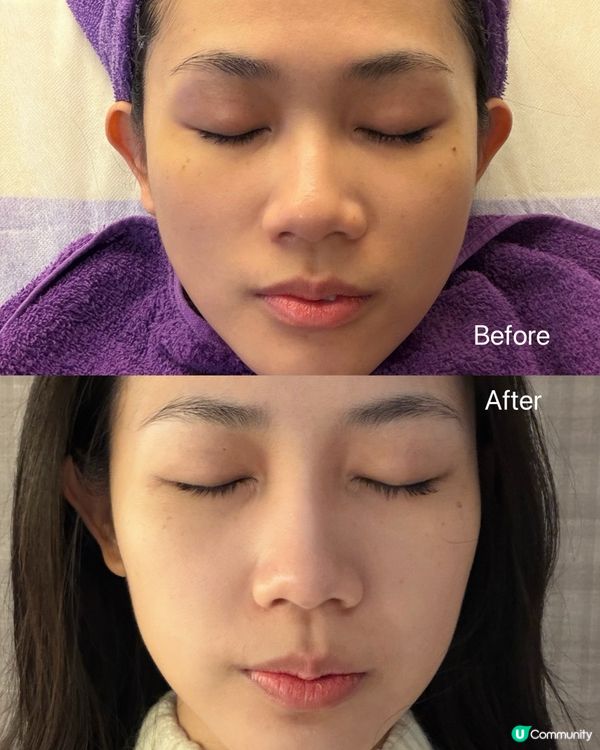 瞓醒都水潤？細胞肌膚再生儀🤩！