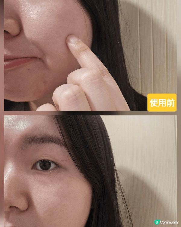 【轉季止痕救星】@cosme No.1 Suu Balm 