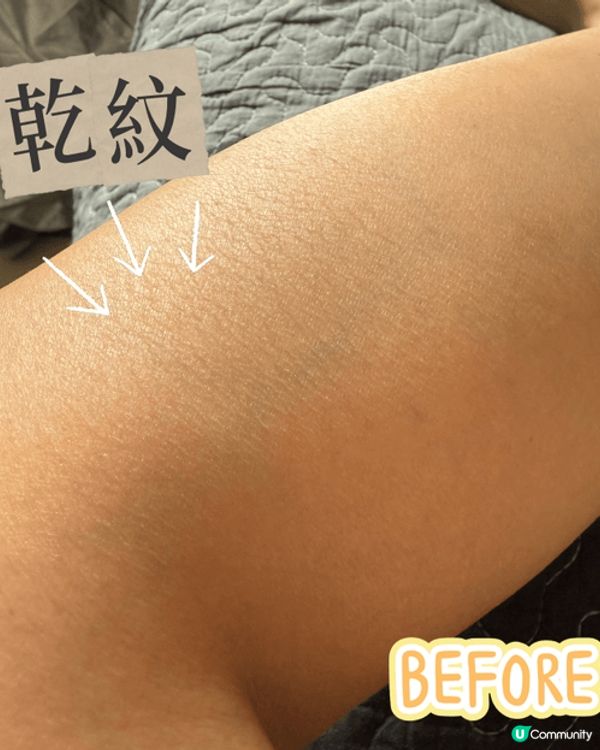 Suu balm 對抗乾燥濕疹肌，其實一年四季，偏光機的我肌...
