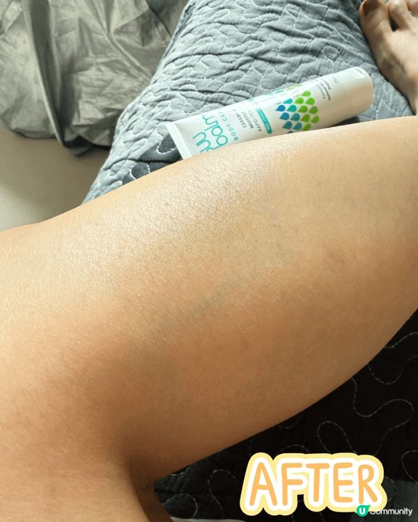 Suu balm 對抗乾燥濕疹肌，其實一年四季，偏光機的我肌...