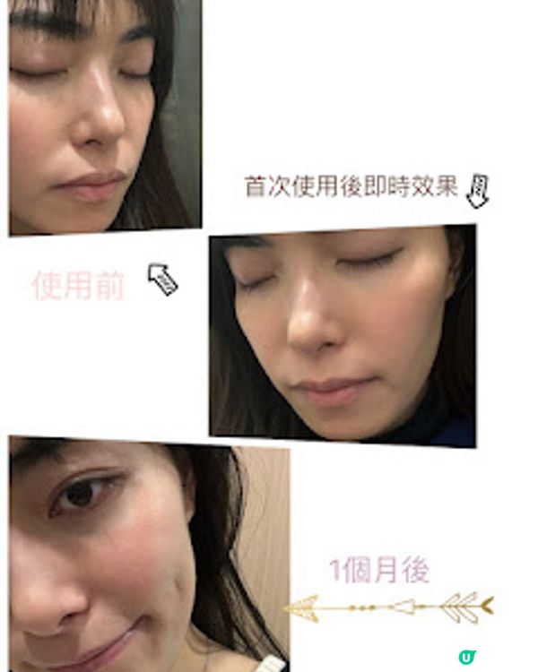 冬天係美白嘅好時機 || Sesderma C-VIT 亮白精華用後感 ||