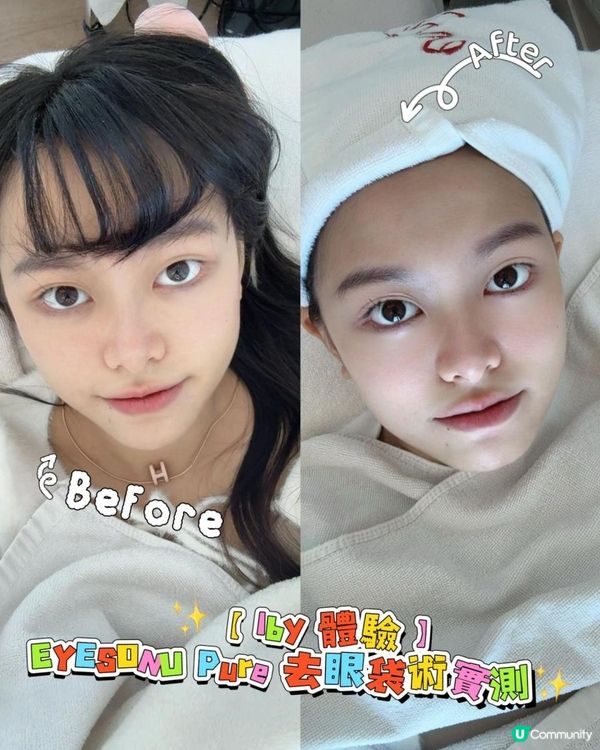 【Iby 體驗】EYESONU Pure 去眼袋術實測！一次見效，無痛改善眼袋黑眼圈 + 肩頸按摩超舒服！