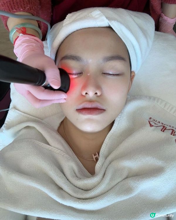 【Iby 體驗】EYESONU Pure 去眼袋術實測！一次見效，無痛改善眼袋黑眼圈 + 肩頸按摩超舒服！