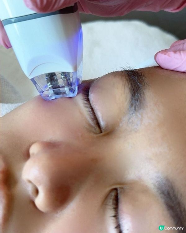 【Iby 體驗】EYESONU Pure 去眼袋術實測！一次見效，無痛改善眼袋黑眼圈 + 肩頸按摩超舒服！