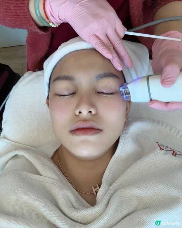 【Iby 體驗】EYESONU Pure 去眼袋術實測！一次見效，無痛改善眼袋黑眼圈 + 肩頸按摩超舒服！