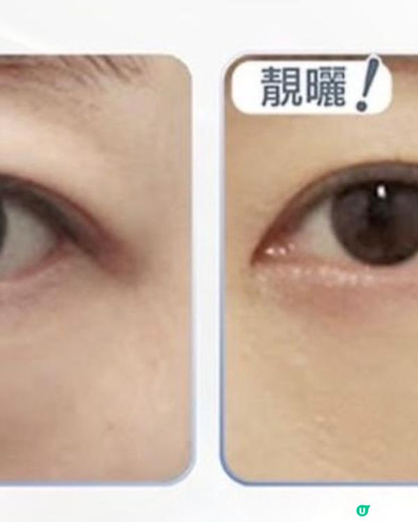 【Iby 體驗】EYESONU Pure 去眼袋術實測！一次見效，無痛改善眼袋黑眼圈 + 肩頸按摩超舒服！