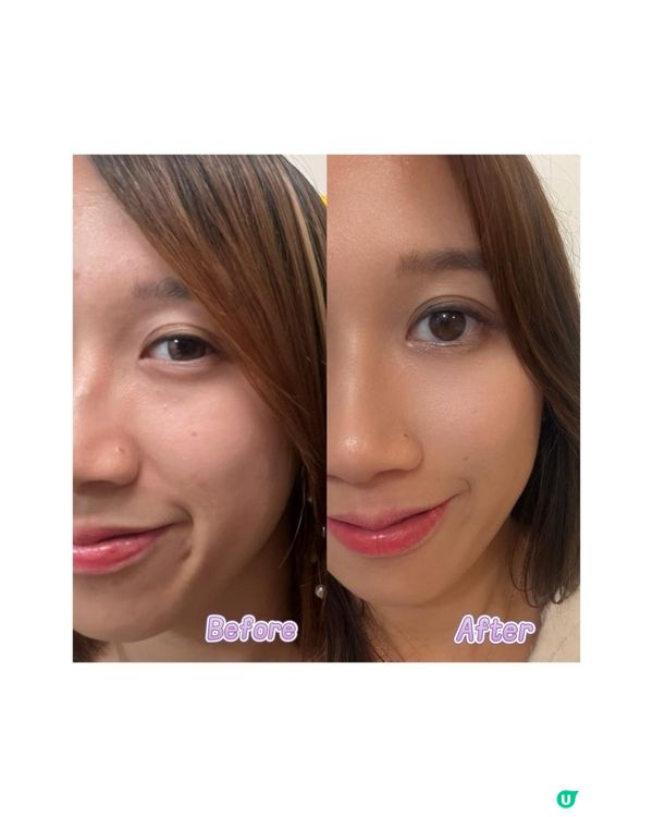 打造健康亮白肌膚嘅秘密武器:Sesderma C-Vit Liposomal Serum