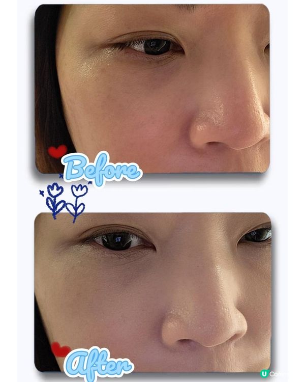 西班牙Sesderma C-VIT 亮白精華，透光肌有跡可尋～