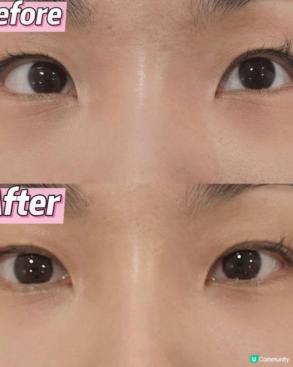 【亮眼重生全記錄】一次療程擊退熊貓眼！ EYESONU Glow去黑眼圈＋按摩 真實體驗