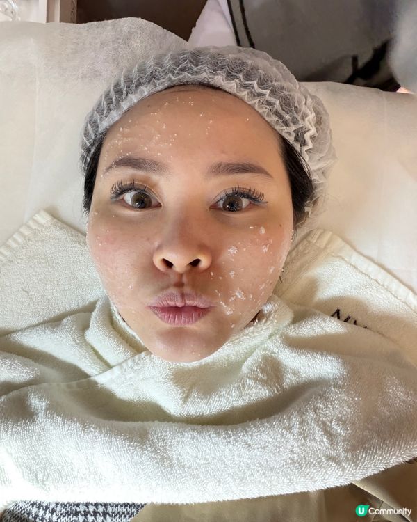 塊臉Firm咗！😍 4代鋼筋索效果驚人！