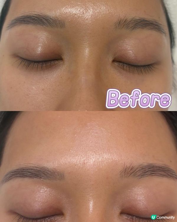焕然一新！EYESONU Glow 去黑眼圈＋按摩療程體驗