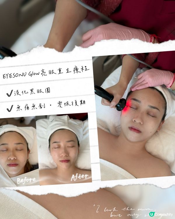 《除咗淡化黑眼圈🖤仲有意想不到嘅去水腫效果😍》