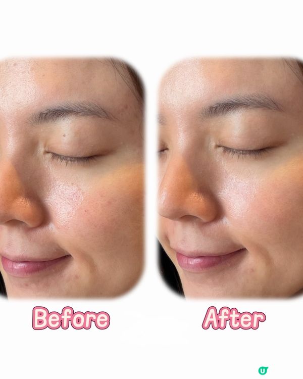 美國純淨護膚品牌Acaderma