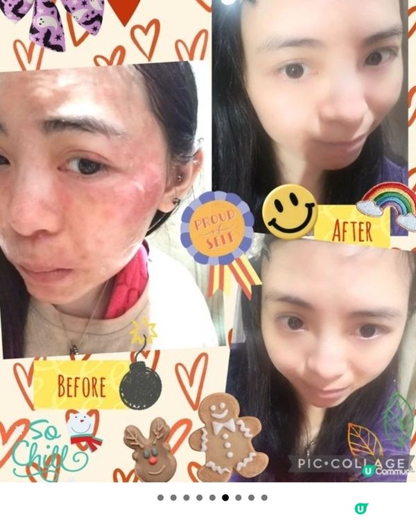 YHKcare精華水~敏感肌