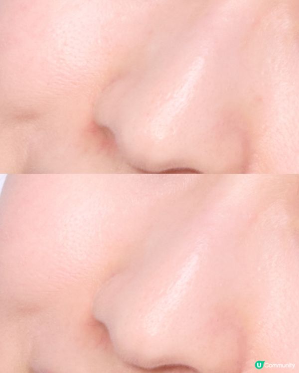 MyLover’s NMN精華