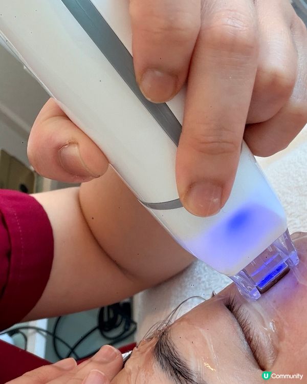 眼袋byebye！一次療程即刻年輕5歲✨