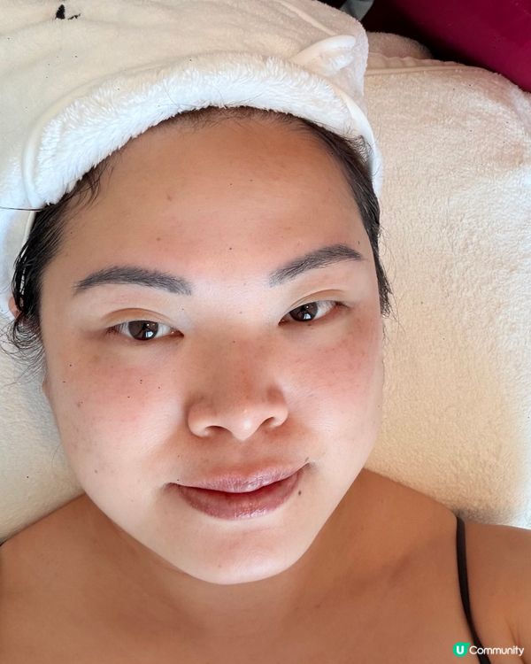 眼袋byebye！一次療程即刻年輕5歲✨