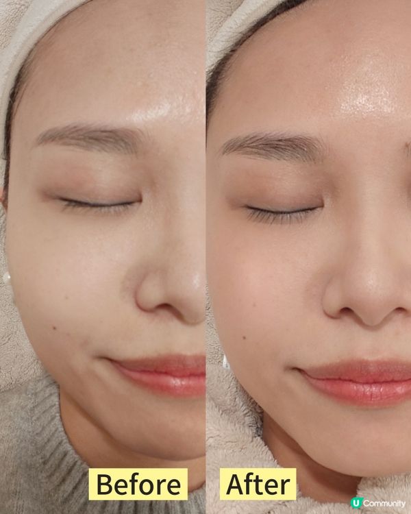 【實測】無針水光救乾肌！💧✨