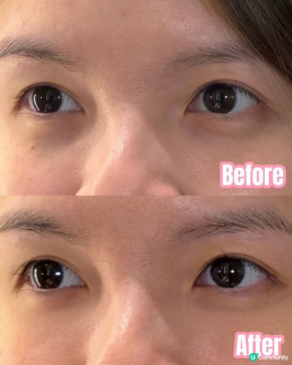 【VIIcode｜淡化黑眼圈氧眼貼】