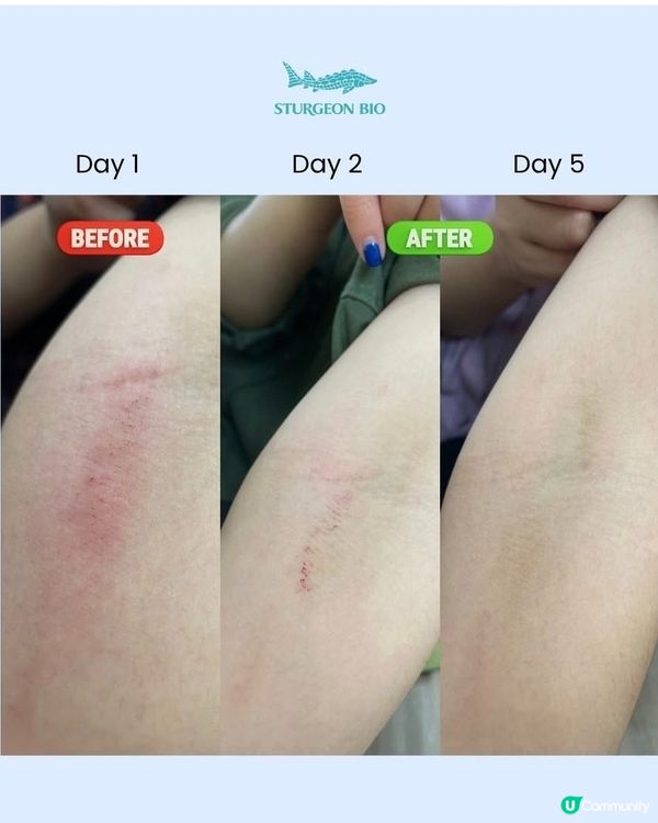 敏肌寶寶救星！🇰🇷 舒緩紅腫痕癢 👶✨