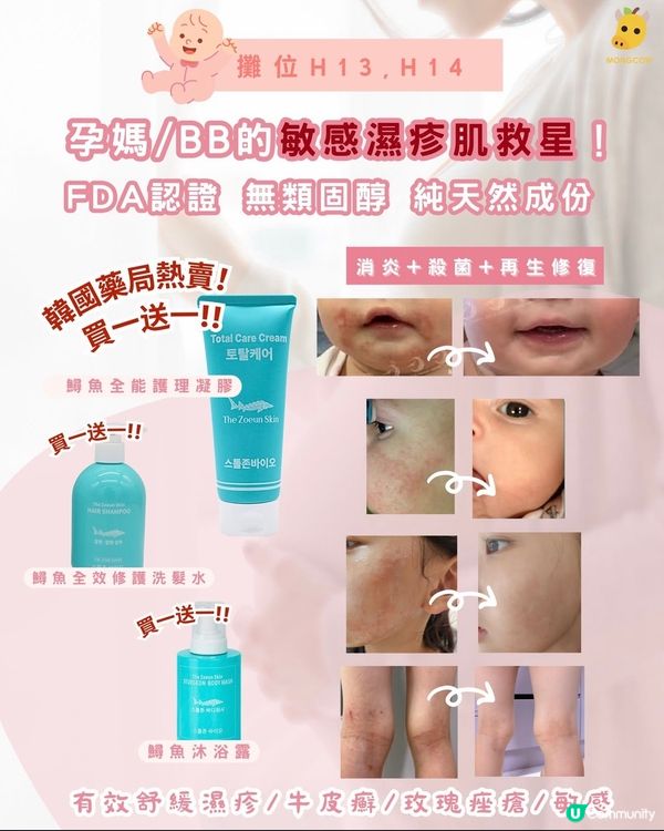 敏肌寶寶救星！🇰🇷 舒緩紅腫痕癢 👶✨