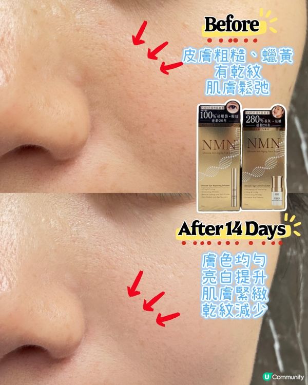 熟齡肌救星！逆齡精華✨勁work！