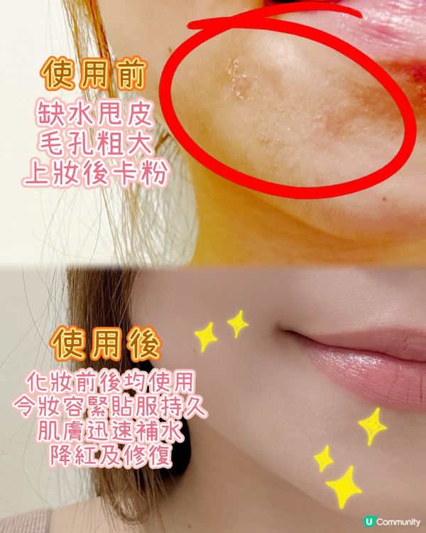 冬日救星！噴霧行走式膠原槍 💧✨