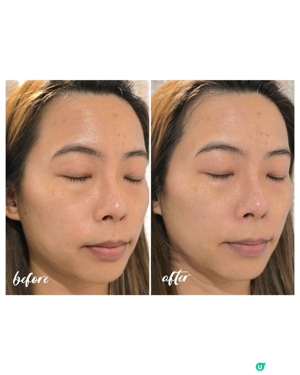 敏感肌護理👍PHYSIOGEL面膜