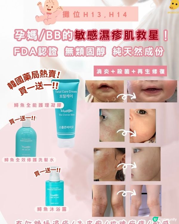 韓國熱賣救星！手仔紅疹 bye bye 👋