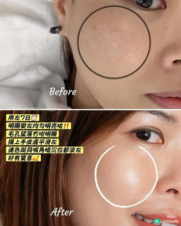 SEPHORA搶到貨！7日細紋毛孔bye bye🥰