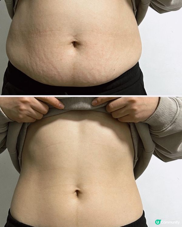 躺瘦秘訣！纖體肽+腸腩清 👖✨