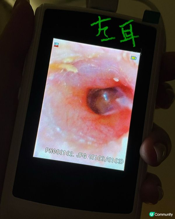 荔枝角採耳好去處