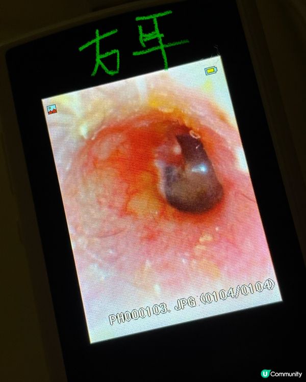 荔枝角採耳好去處