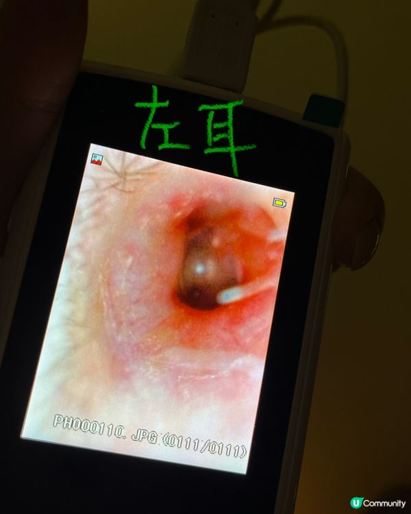 荔枝角採耳好去處