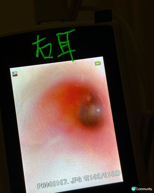 荔枝角採耳好去處