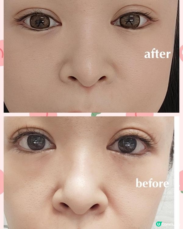 【✨肌齡逆轉 の MyLover's NMN黃金逆齡精華液✨】