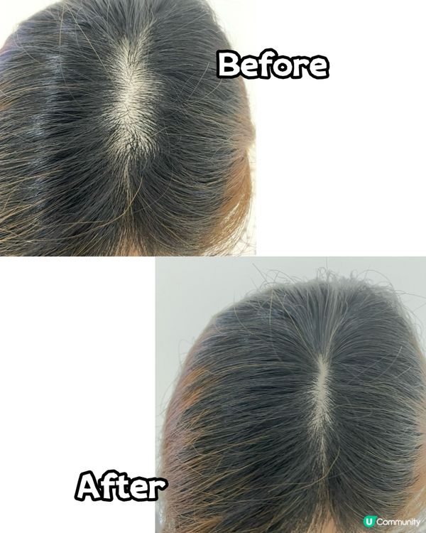 每次用10分鐘‼️頭髮增量126%💢