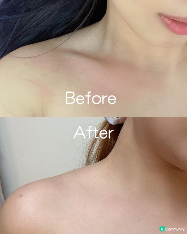 敏感肌救星！告別泛紅痕癢！✨