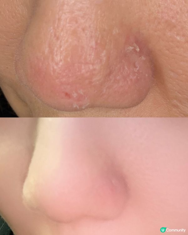 主婦手救星！告別爆拆甩皮！✨