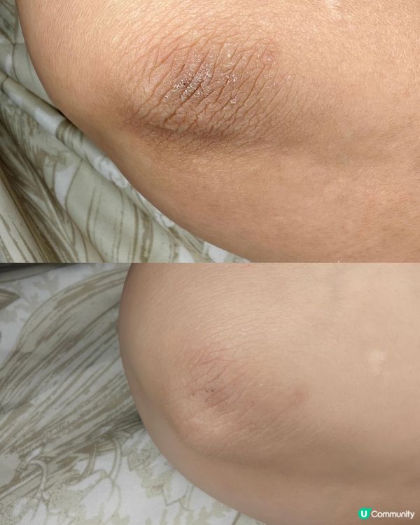 主婦手救星！告別爆拆甩皮！✨