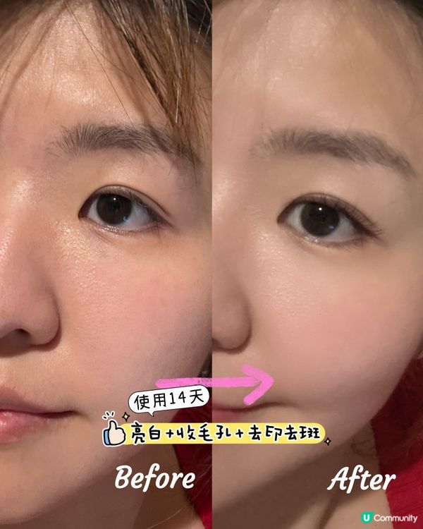 光療面膜儀✨ 全單9折變靚！