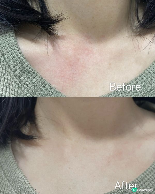 天氣一轉乾燥敏感肌救星！💯✨