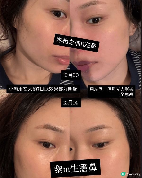 完美打造零毛孔 現實磨皮filter!!!!!! 全部都係用...