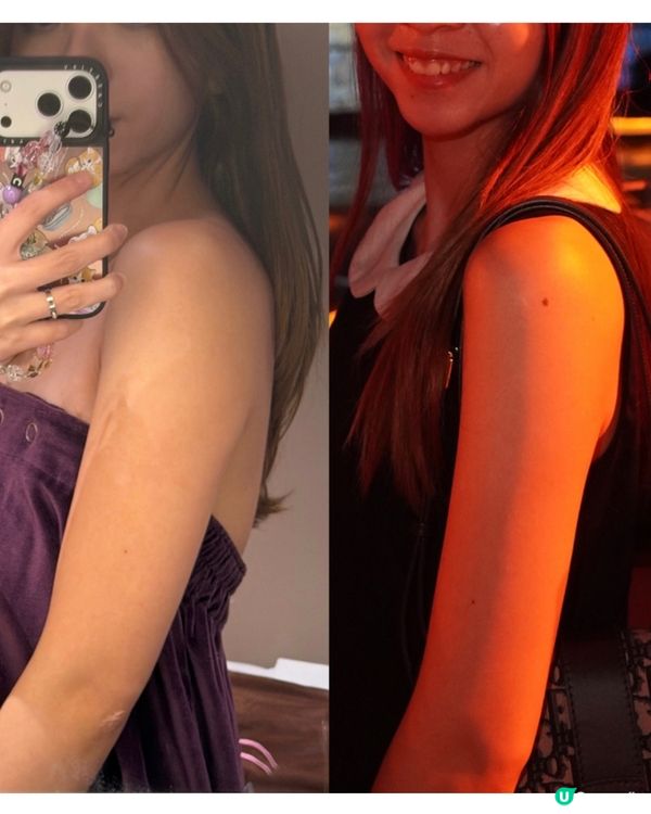 【WholeLove Plus｜纖體&腸腩清益生菌】